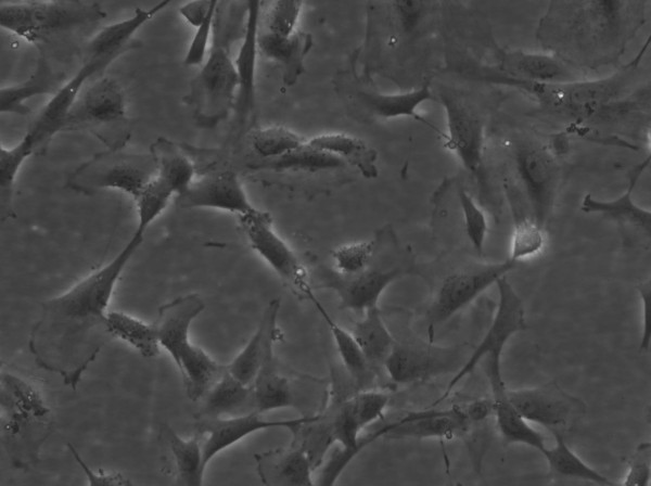 Wilms2 Cells