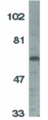 Anti-IL-1RAcP