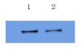 Anti-IL6, clone 2E10