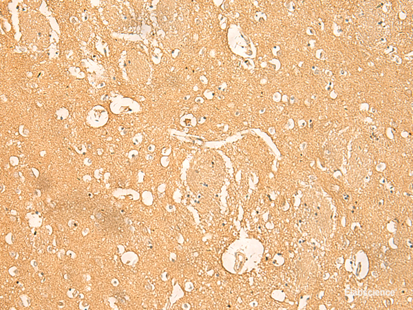 Anti-RNASE4