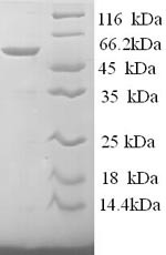 S-arrestin (SAG), human, recombinant
