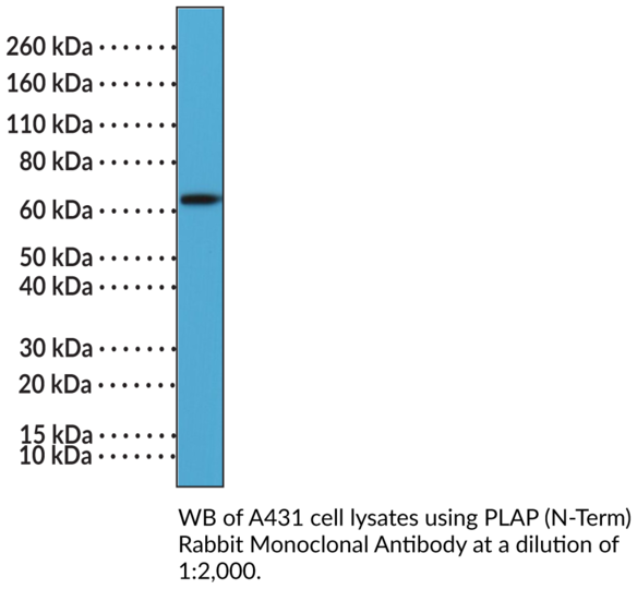 Anti-PLAP (N-Term) Rabbit Monoclonal Antibody (Clone RM317)