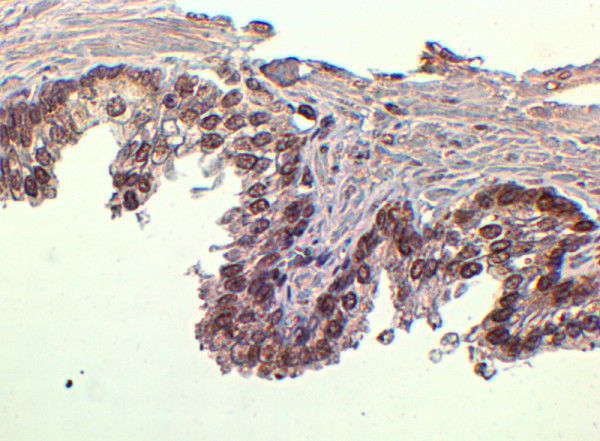 Anti-FOXA1, C-terminal