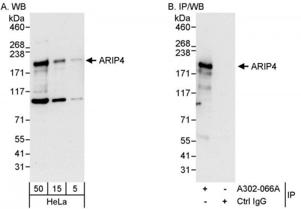 Anti-ARIP4