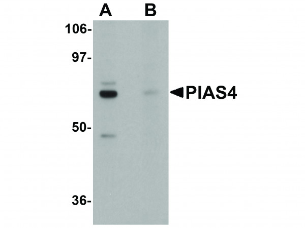 Anti-PIAS4