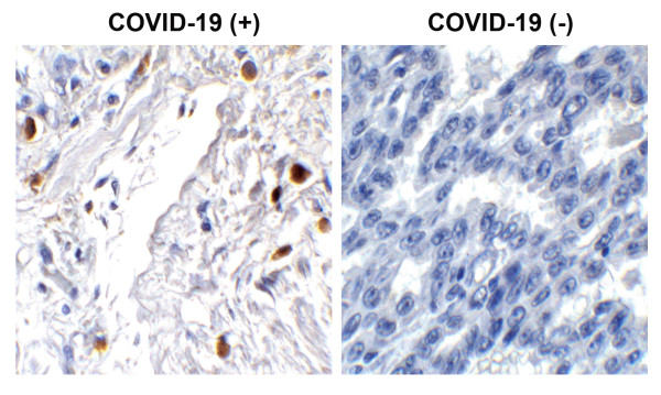 Anti-SARS-CoV-2 ORF7a