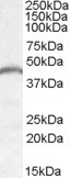 Anti-PNPLA3 / Adiponutrin, Internal
