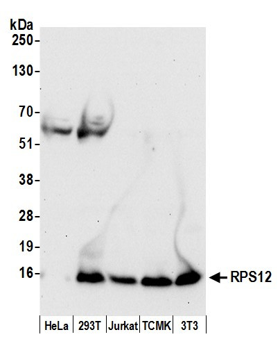 Anti-RPS12/Ribosomal Protein S12