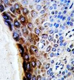 Anti-CTHRC1