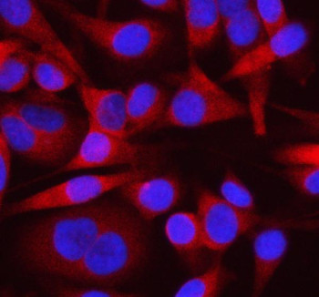 Anti-OTUD3 / OTU domain-containing protein 3