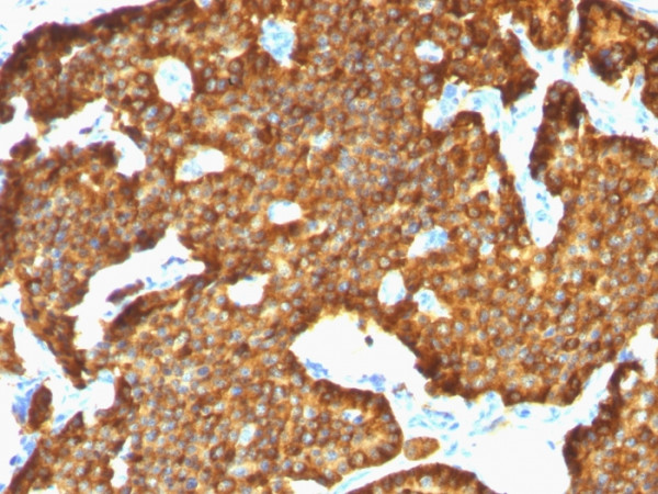 Anti-Chromogranin A (Neuroendocrine Marker), clone SPM553