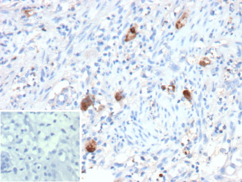 Anti-Cytomegalovirus / UL83 / CMV matrix protein pp65, clone rCMV/12688