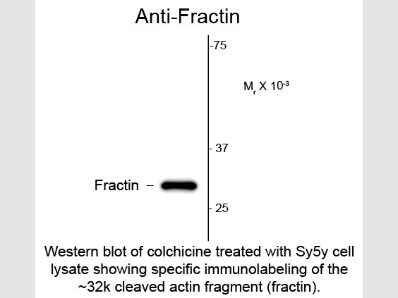 Anti-Fractin