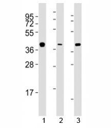 Anti-ERCC1, clone 752CT13.2.5