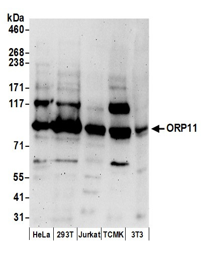 Anti-ORP11