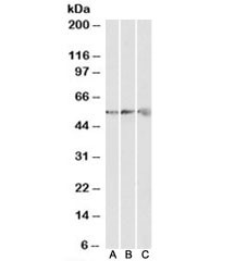 Anti-ATP5B