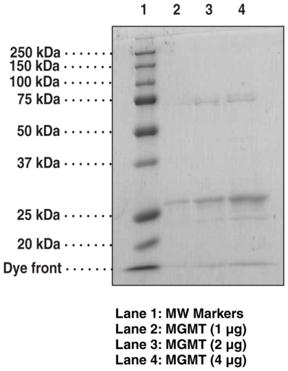 O6-methylguanine-DNA Methyltransferase (human, recombinant)
