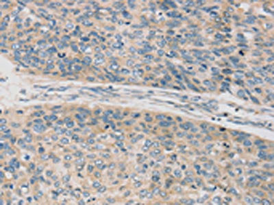 Anti-TPH2