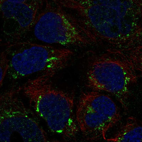 Anti-ATP7B