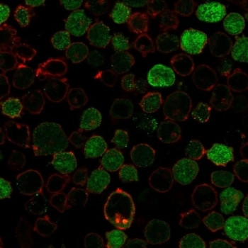 Anti-Bcl10, clone BL10/2988R