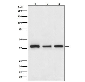 Anti-Cathepsin / L-V-K-H, clone AACD-3