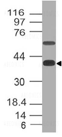 Anti-CD161 (Clone: ABM2D74)