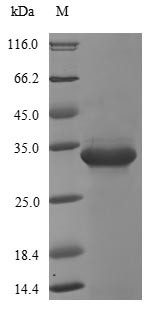 Transcriptional regulatory protein phoP (phoP), Escherichia coli, recombinant