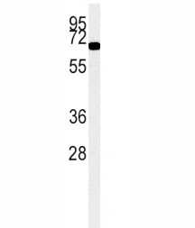 Anti-ACOX1 / Peroxisomal acyl-coenzyme A oxidase 1, clone 153CT43.1.1