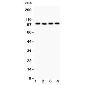 Anti-TRPC7