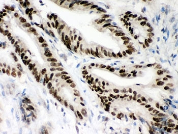 Anti-MSH2