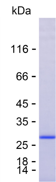 Recombinant Human C-Reactive Protein Protein