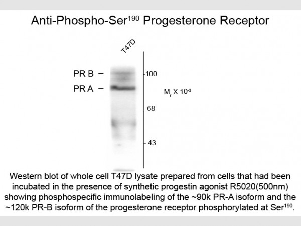 Anti-phospho-Progesterone Receptor (Ser190), clone 1154