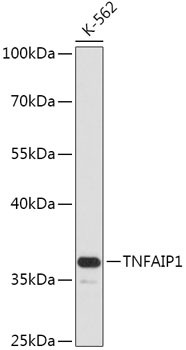 Anti-TNFAIP1 [Rabbit] (CAB17543)