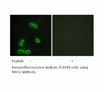 Anti-MUC1