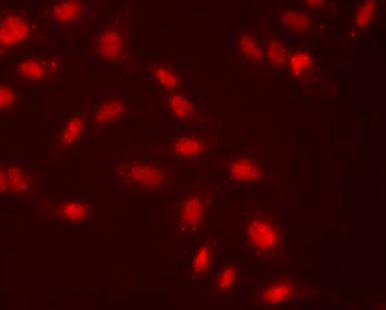 Anti-HSF2