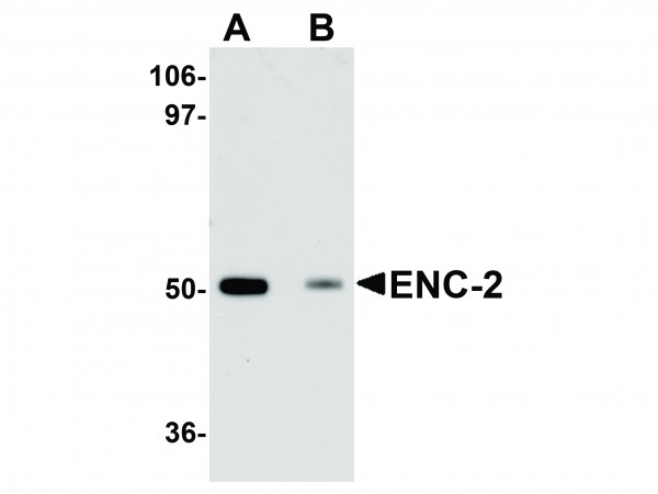 Anti-ENC-2