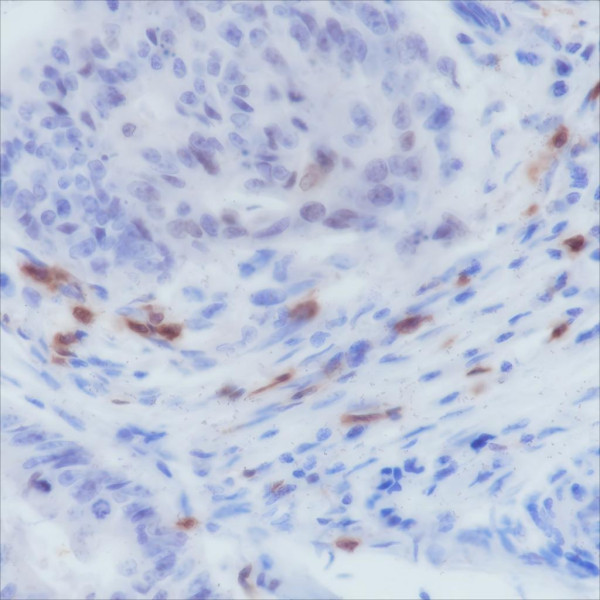 Anti-Recombinant CD103, clone A155