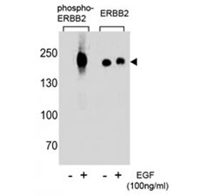 Anti-HER2 (ERBB2) (phospho-Y1248)