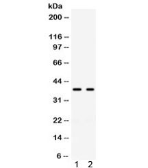 Anti-GAL4 / Galectin-4
