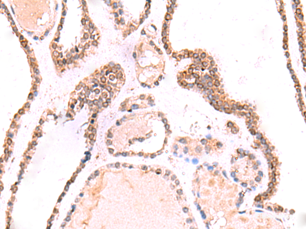 Anti-TOR1AIP1