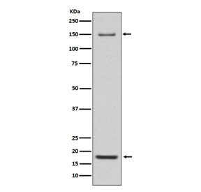 Anti-Integrin alpha 5 / ITGA5, clone IDB-9
