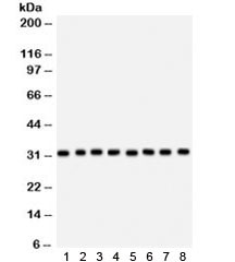 Anti-SMN1/2 / Survival of Motor Neuron 1/2