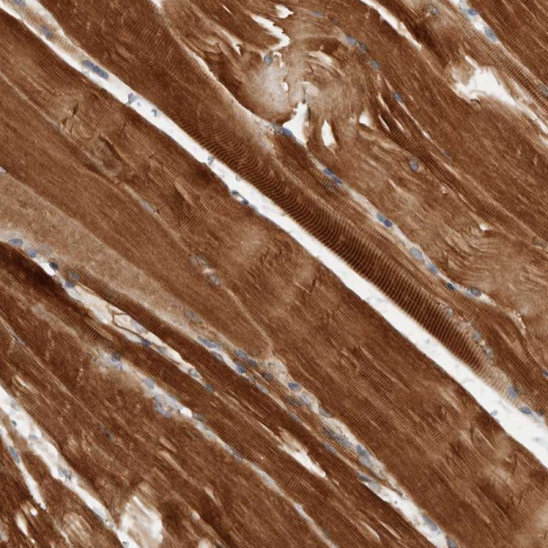 Anti-AMPD1