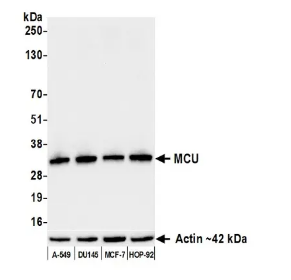 Anti-MCU Recombinant Monoclonal