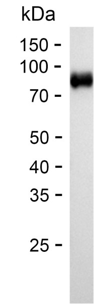 Recombinant Human Lactoferrin Protein