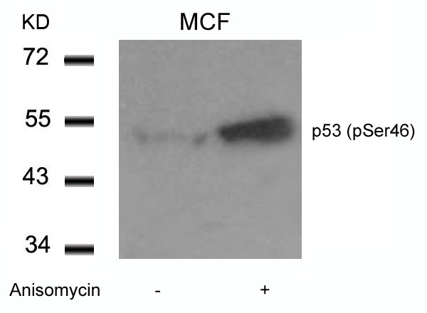 Anti-phospho-p53 (Ser46)