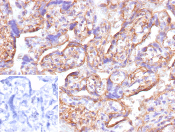 Anti-CD147 / Emmprin / Basigin, clone rAB1843
