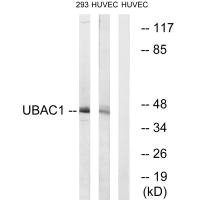 Anti-UBAC1