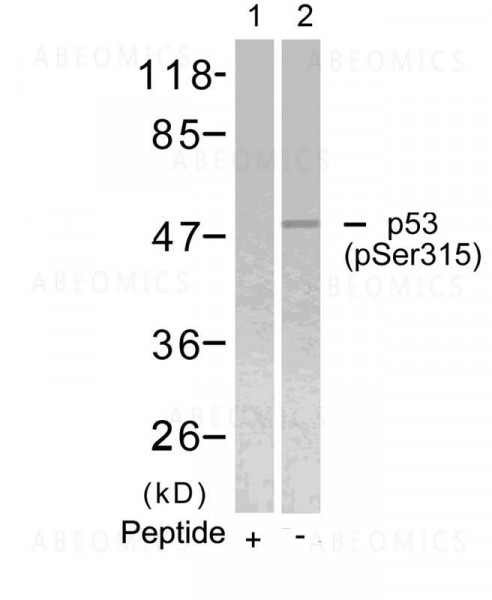 Anti-phospho-p53 (Ser315)