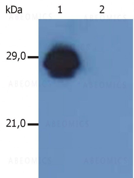 Anti-HLA-DR+DP Monoclonal Antibody (Clone:MEM-136)
